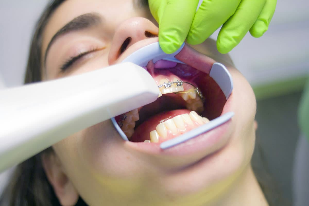 Treatment Image